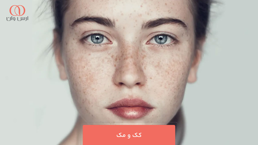 کک و مک (Freckles)